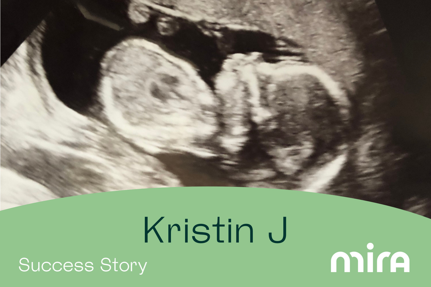 Success Story Kristin